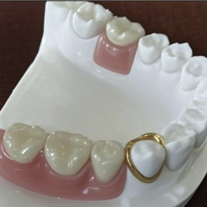 Прецизно прикачване