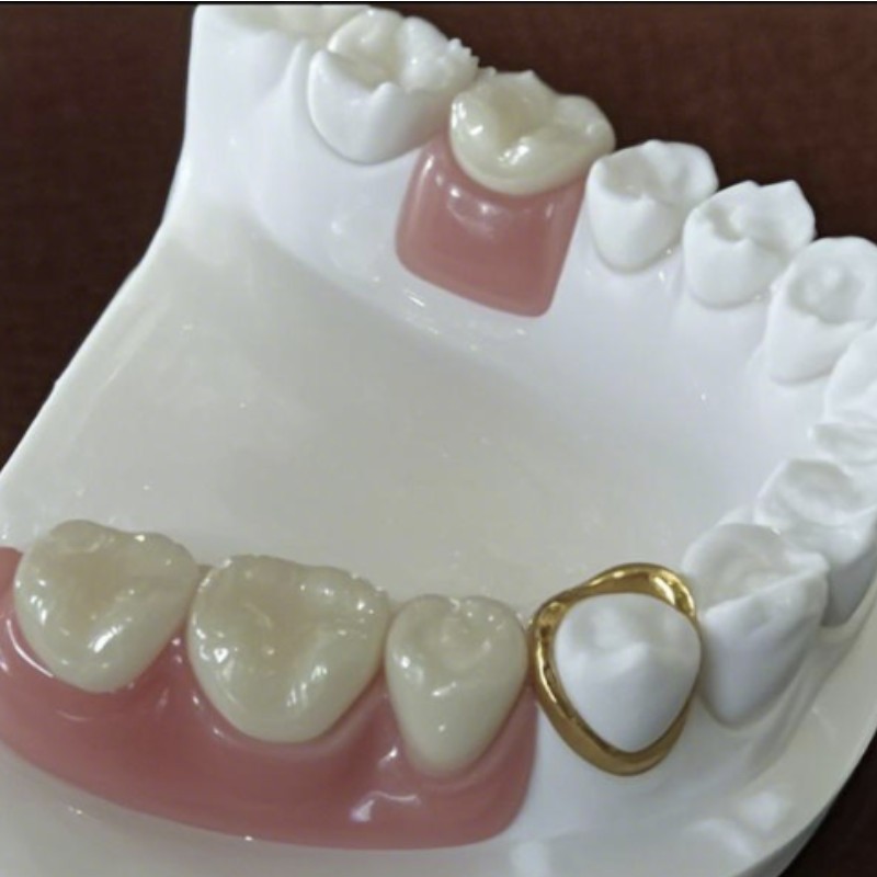 Прецизно прикачване